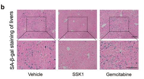 什么办法可以抗细胞衰老,如何抗糖化抗衰老