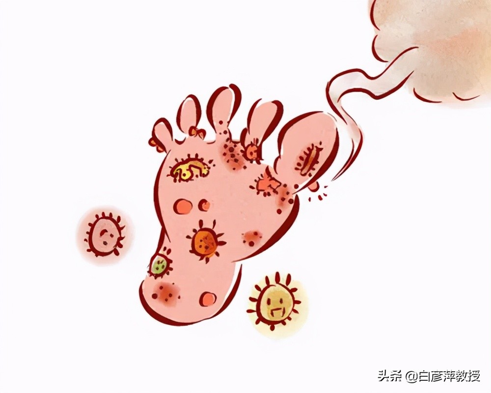 轻轻一划皮肤就会出现红痕,划皮肤出现红色印子是划痕症吗