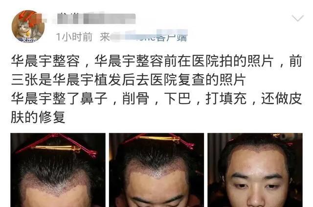 整容、劈腿、被喊老公？华晨宇被圈外女猛锤，人设崩塌