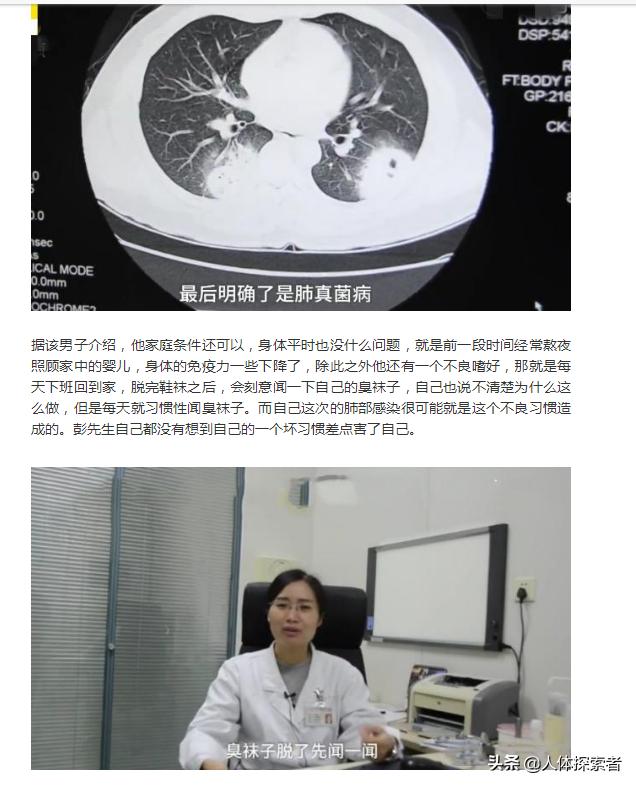 张医生谈癌症治疗,张医生讲疾病