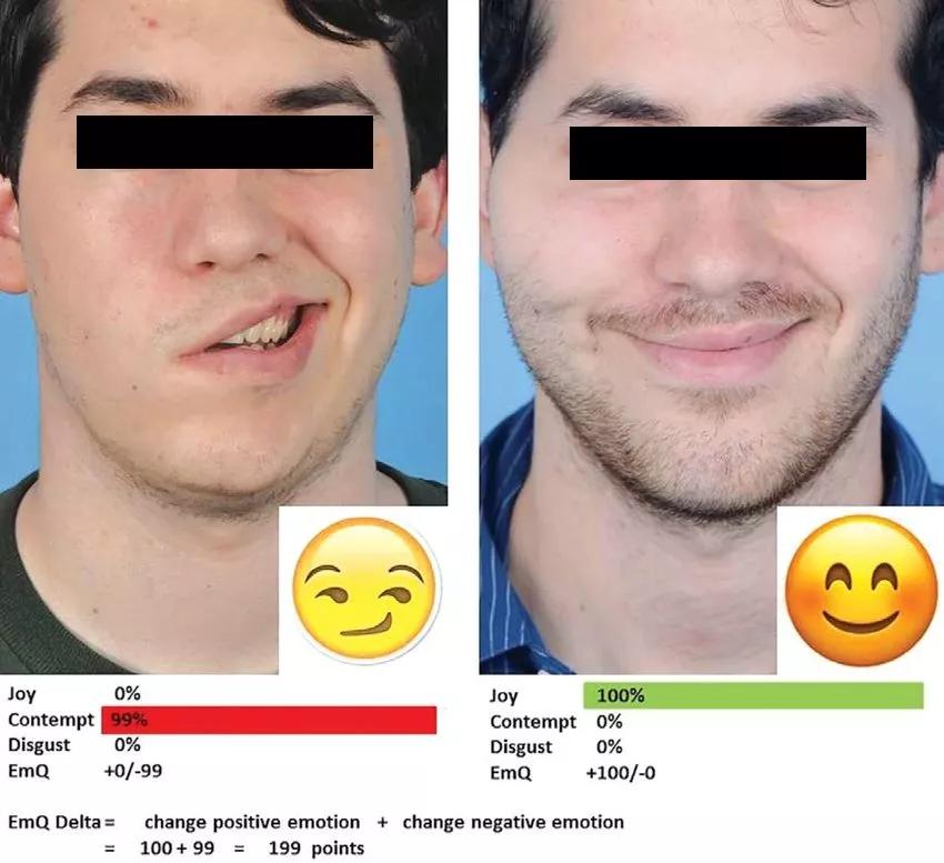 听神经瘤突聋能恢复吗,听神经瘤耳聋了怎么办