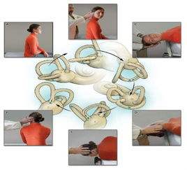 爱耳日科普系列正确认识耳鸣,爱耳日科普资料