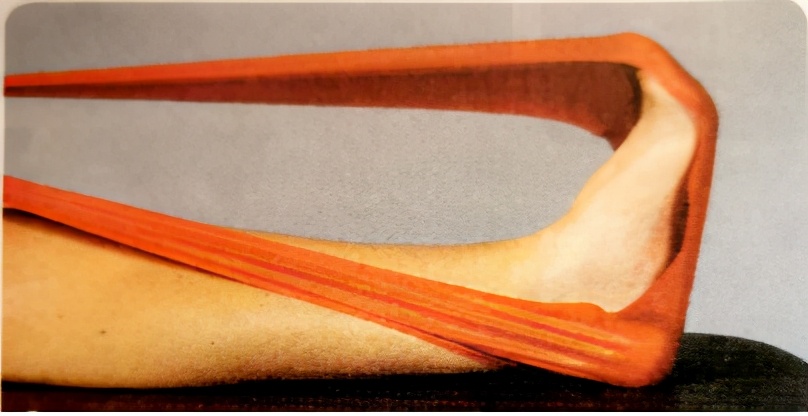 把o型腿变直手术过程,o型腿和xo型腿哪个更难矫正