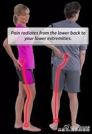 压到坐骨神经怎么缓解,坐骨神经痛吊单杠缓解