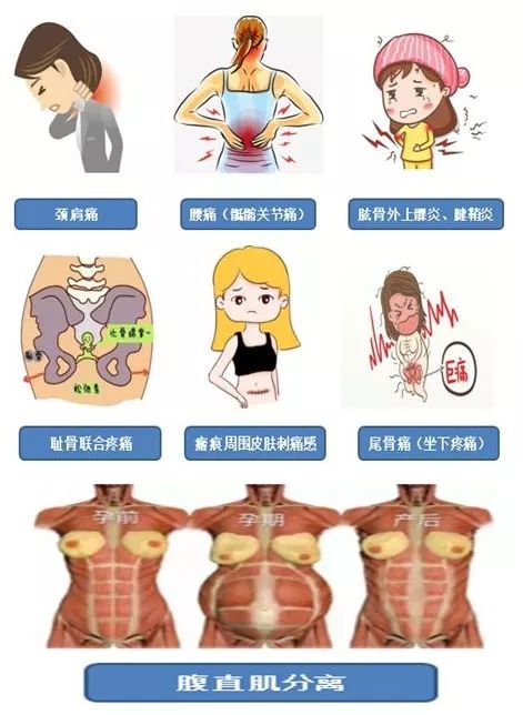 苏州阿姨30多年的难言之隐终解决,这个病许多妈妈有