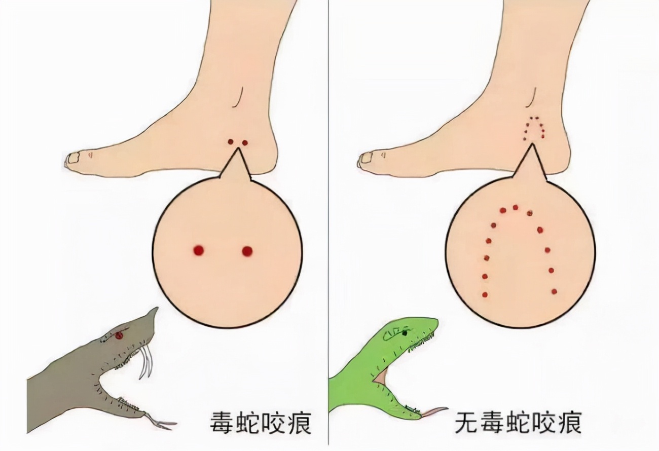 蛇的报复性有多强？被斩掉蛇头20分钟后，还可以咬人中毒身亡