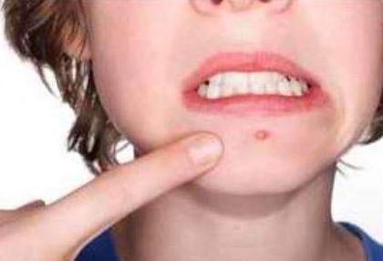 俏肌去黑头怎么样,俏肌护肤品怎么样