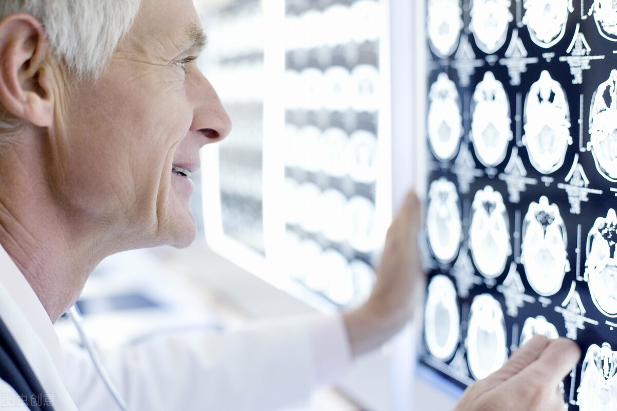 经常头痛但是ct没问题,经常头痛做ct和核磁共振都正常