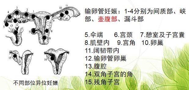 急诊宫外孕休克住院抢救流程,宫外孕被送医院抢救