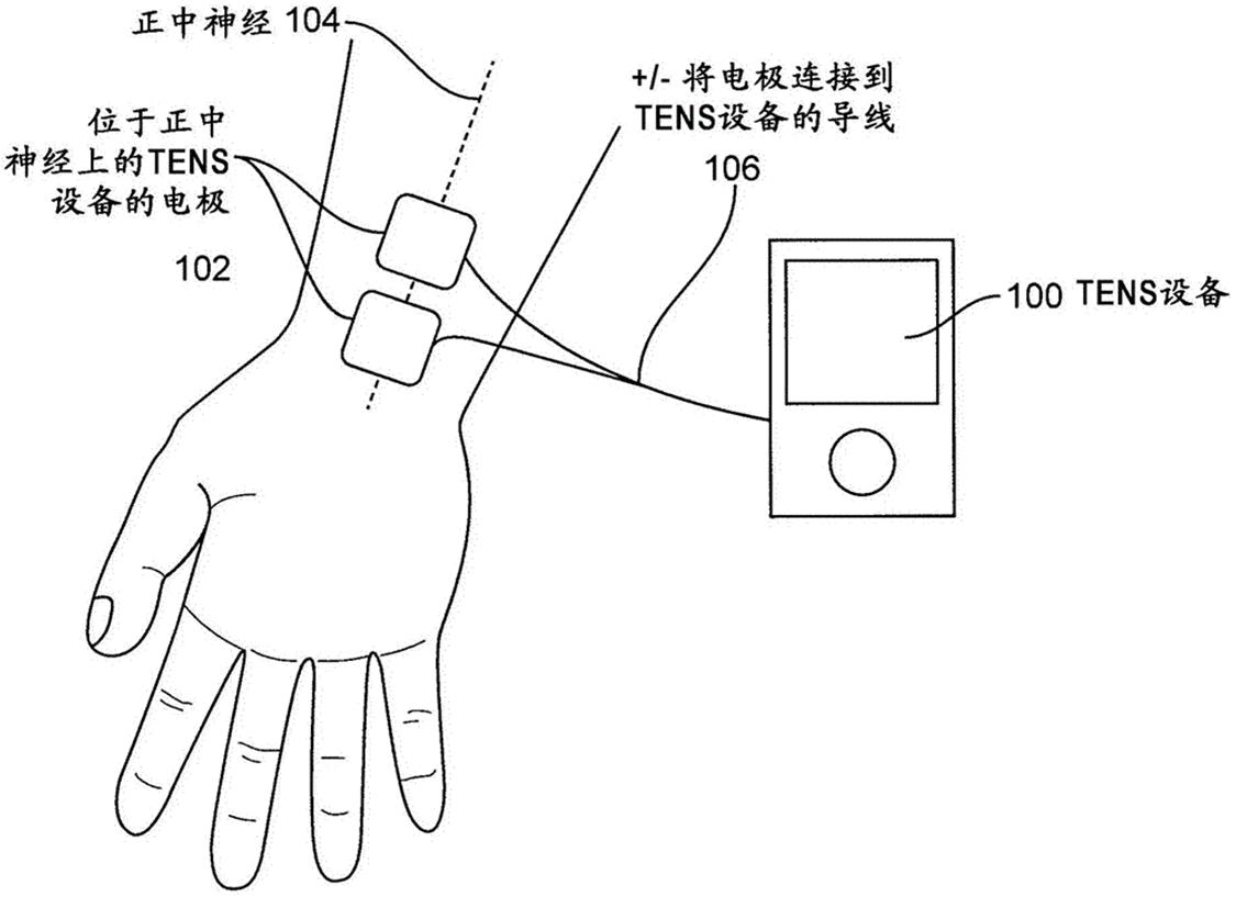 帕金森难题,攻克帕金森的最佳方法