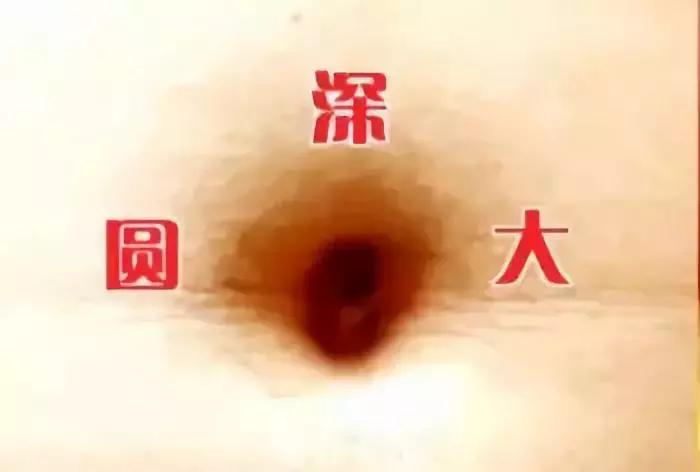 最重要的穴位对应病症,各种疾病的穴位压痛点