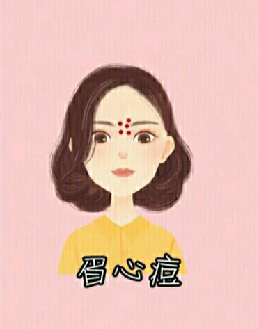 男生脸上各个部位长痘痘图解,脸上不同部位长痘痘的原因