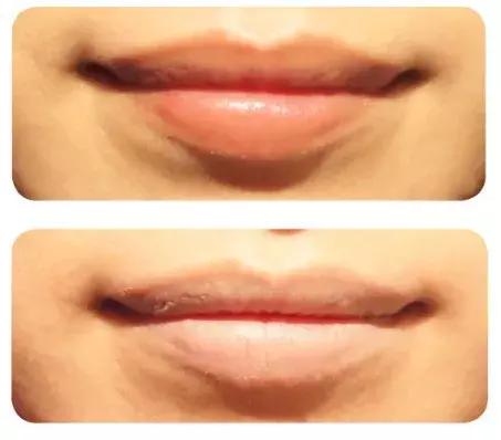 夏季怎么让皮肤降温,夏天很热你知道哪些降温小妙招