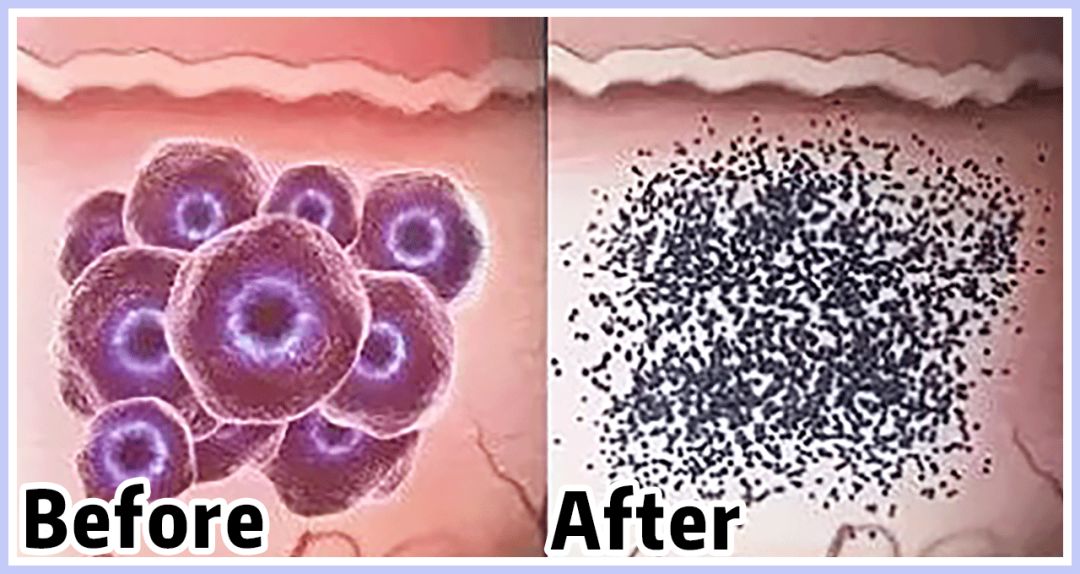 如果被祛痘机构坑了怎么办,我被私立医院骗了怎么办