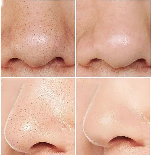 杨幂教你全身美白护肤秘籍,杨幂常年在用的护肤秘诀