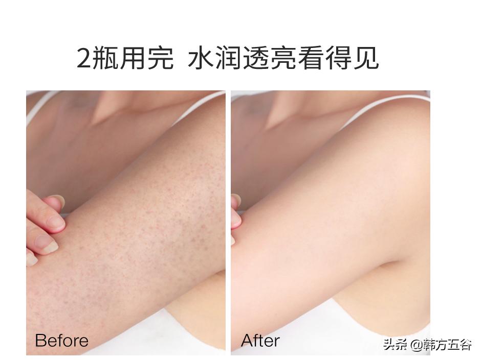 搓澡之后毛孔有血点怎么弄掉,搓出皮肤脏东西