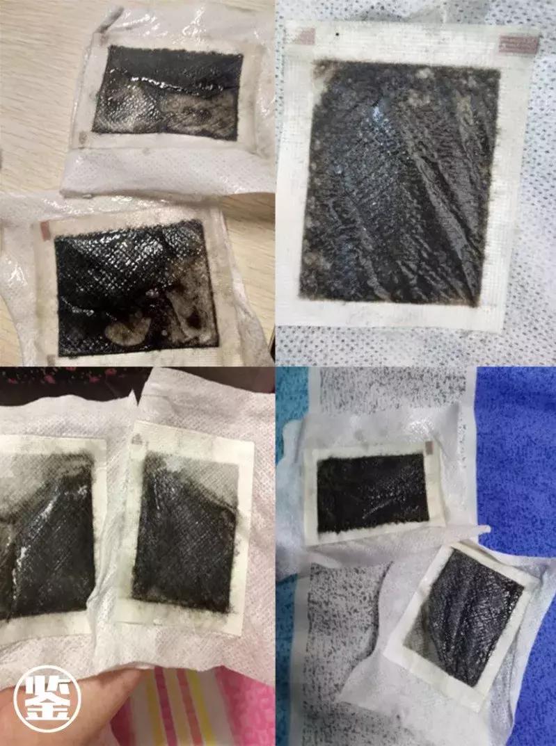 双十一我的第一个快递是假货！泰国爆款皇家足贴真假辨别