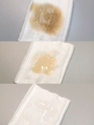 揭秘网红店美容院的成功秘诀,揭露美容院骗局