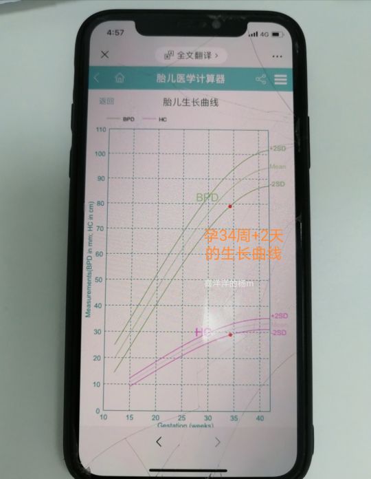 怀孕29周加6天胎儿偏小一周正常吗,孕37周宝宝4斤多正常吗
