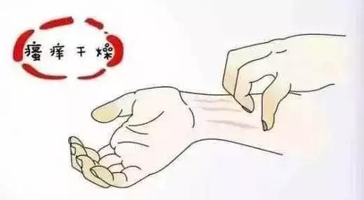 这种病虽不起眼，却能让人痒到怀疑人生，冬季高发！