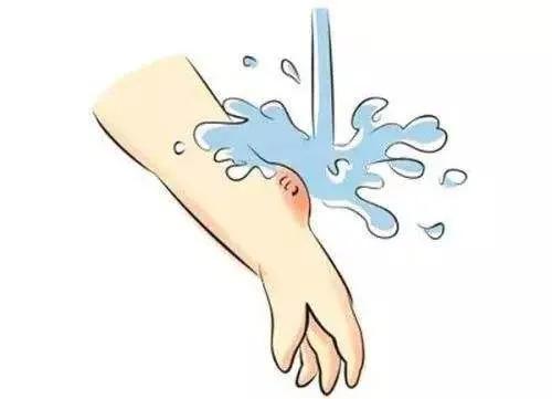 春游被蚊虫咬了怎么办,五一踏青小心毒虫叮咬