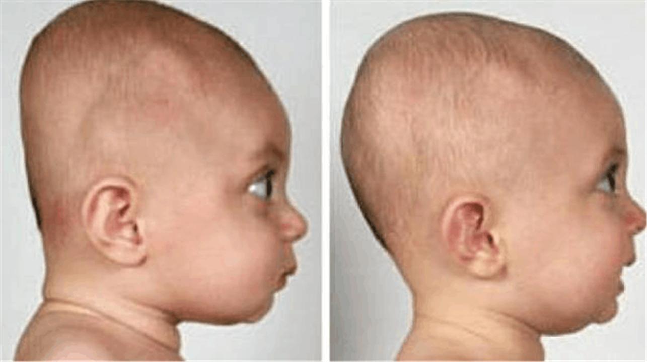 睡枕头和不睡枕头哪个好,睡枕头和不睡枕头的儿童