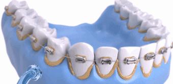 年轻人想要拒绝口臭，就该从饭后b-box开始练起