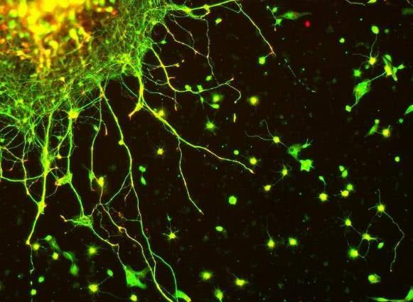 大脑的神秘现象,大脑意识之谜