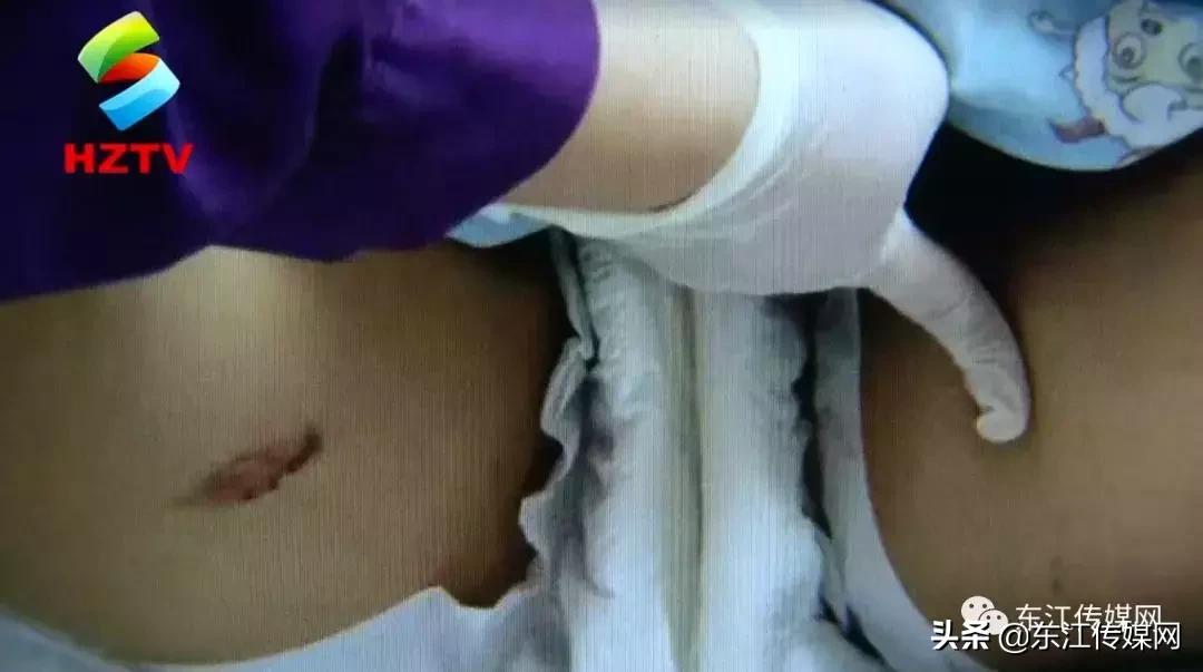 17岁学生疑触电,女子游泳池遭电晕