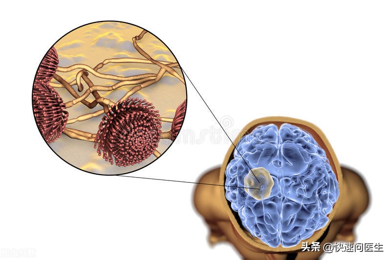 白带发黄是什么妇科病怎么治,白带发黄属于哪种炎症