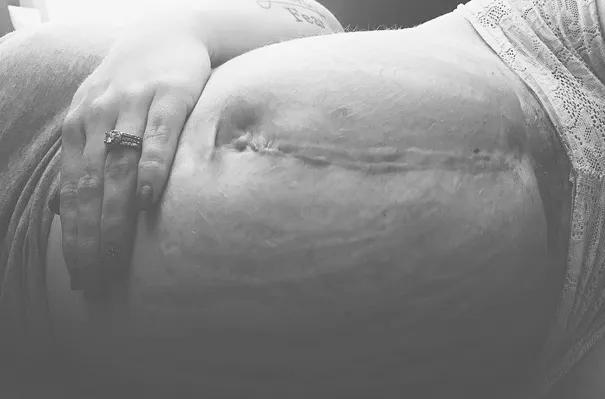 拿什么拯救你我的快乐,拿什么拯救你我身上的疤痕