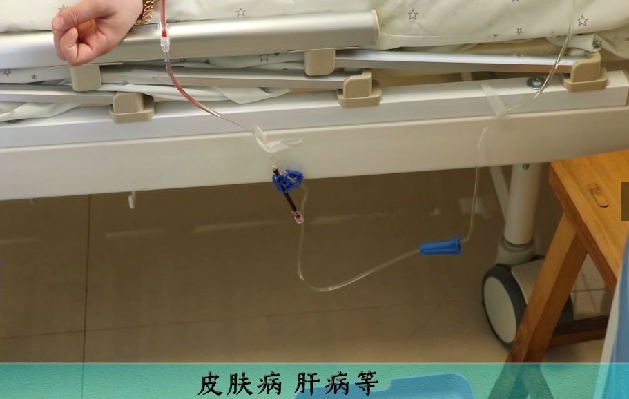 洗血疗法排毒方法视频讲解,三氧净血疗法视频