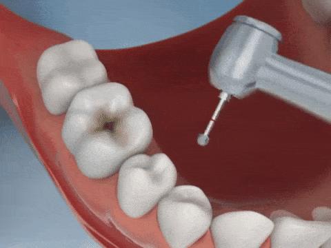 一场骗局的真相,美国牙医靠谱吗