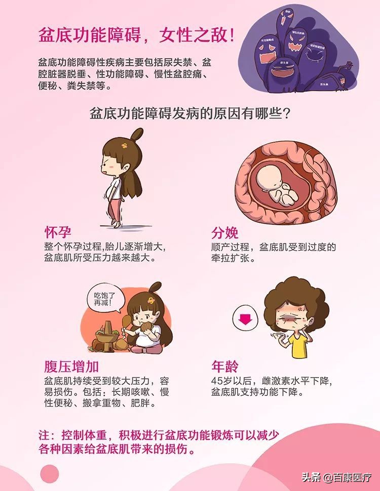 科普视频盆底肌康复训练,盆底肌医学讲解