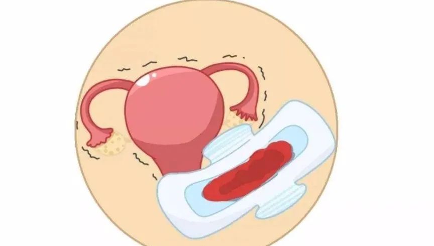 排卵期出血黑褐色粘稠,排卵期出血会是宫颈癌