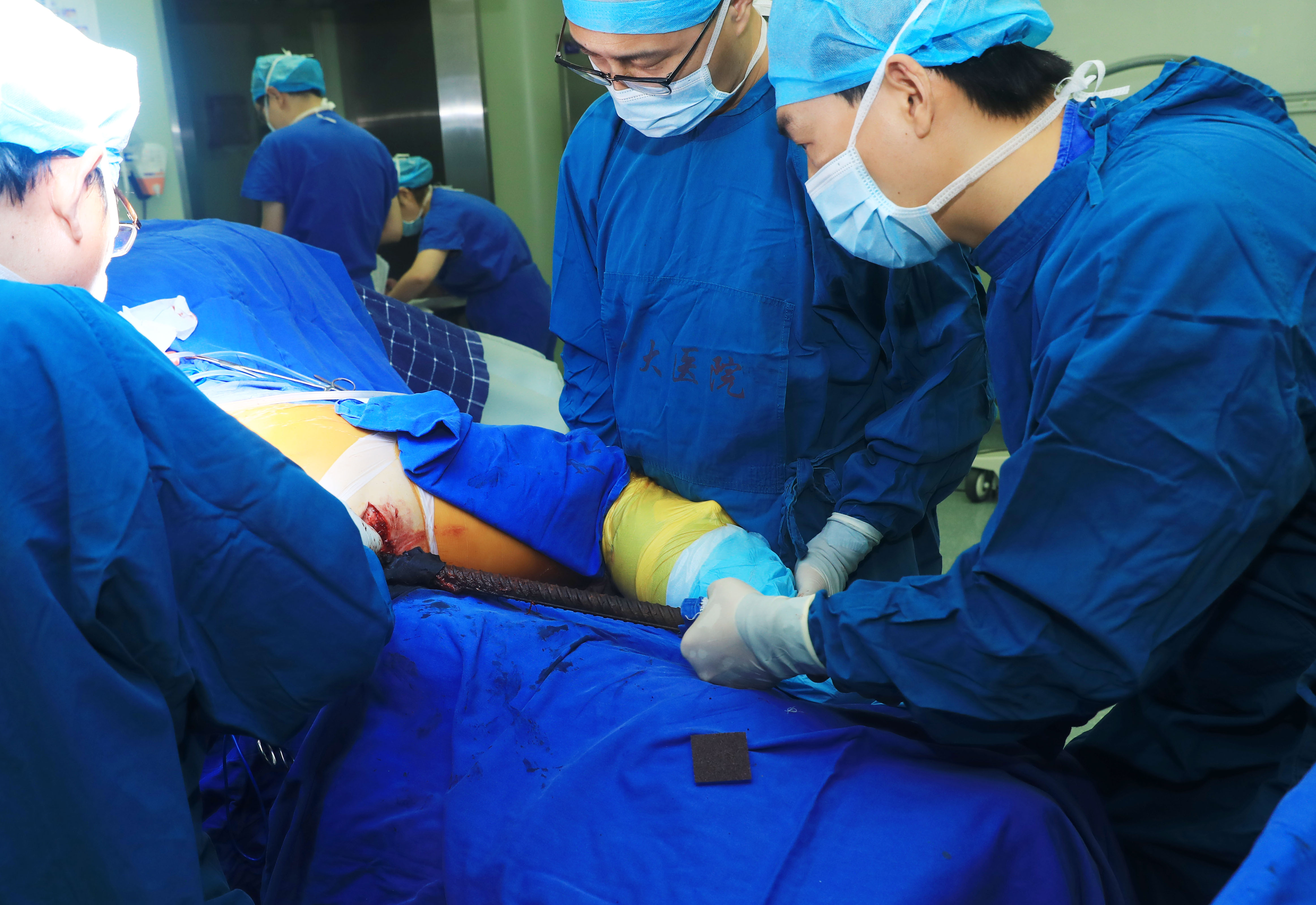 突发:90厘米长钢筋从会阴部插入穿腹入背结局:中大医院创伤中心多学科抢救化险为夷