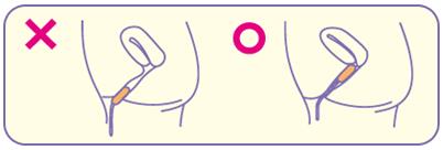 我用的不是棉条,是自由丨棉条科普