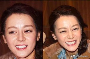 眼角皱纹最显老要注意防晒,眼角皱纹去皱最有效的方法