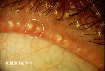 中医治疗的经历和感受,中医治疗中医好吗