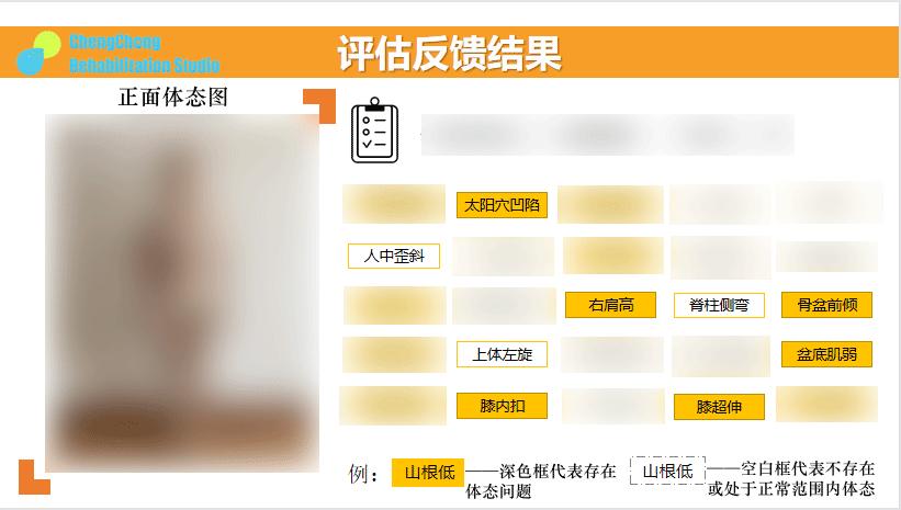 改善腿型的两腿平行的动作,女腿不直o型腿怎么矫正腿型
