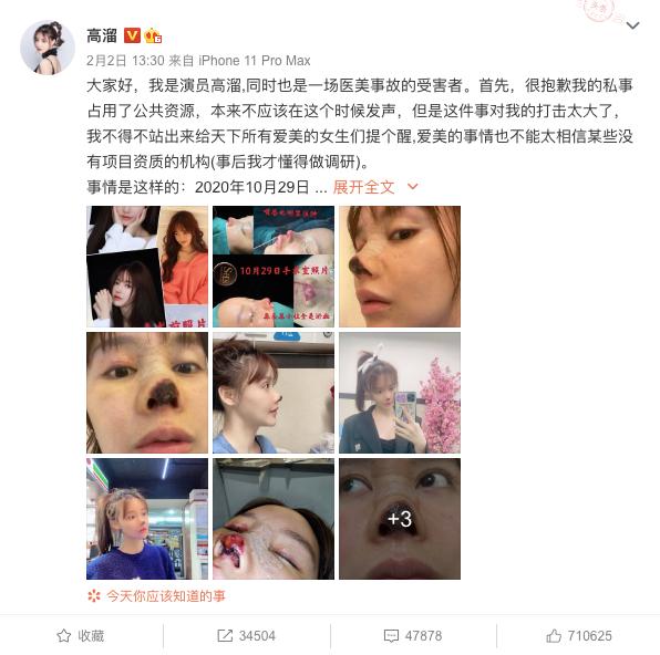 女艺人整容失败有哪个,女演员整容失败变老视频