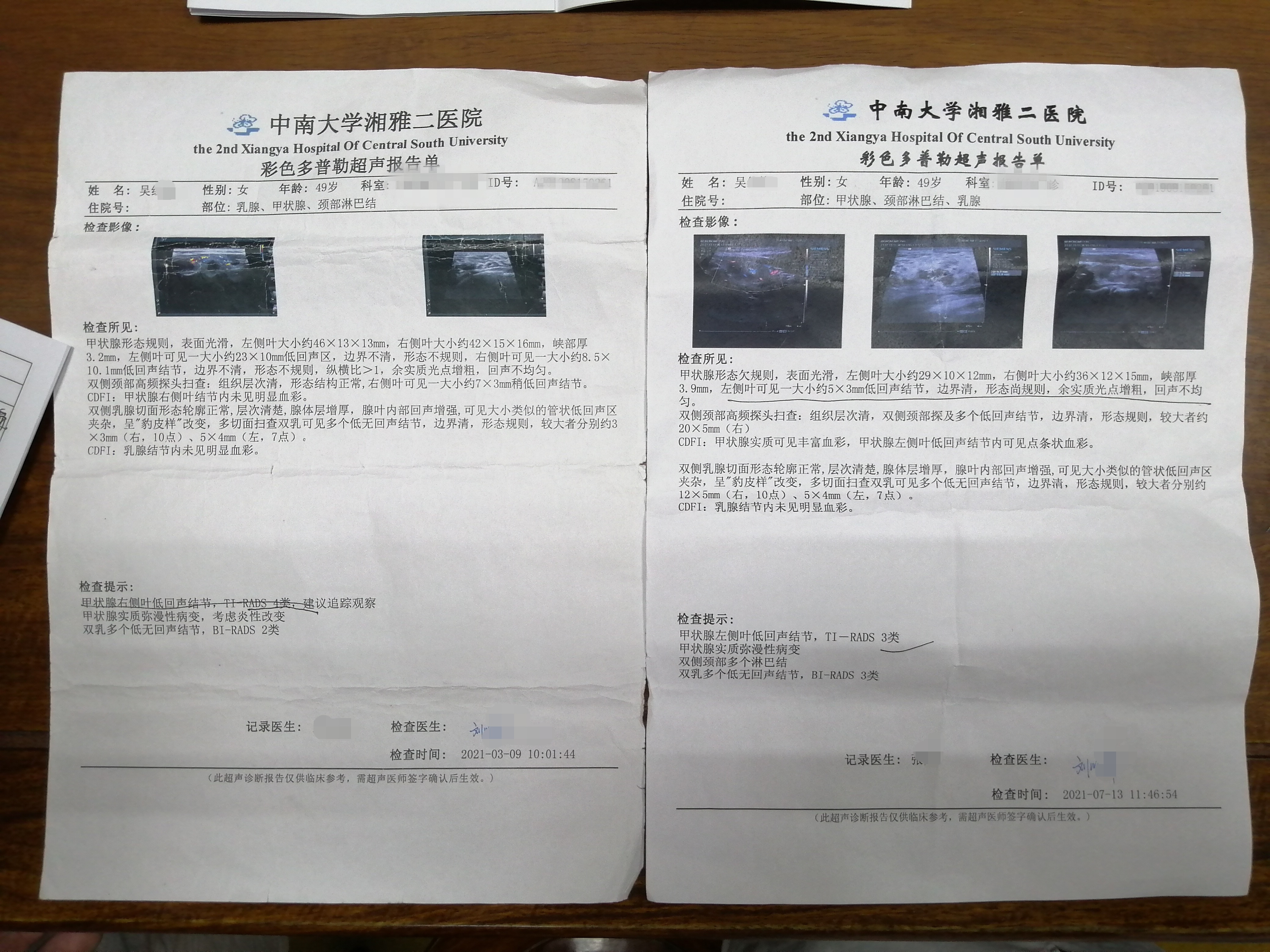 程丑夫名老中医治甲状腺结节经验