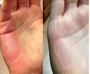 泰国青草止痒膏正品方便携带,夏季必备泰国青草膏