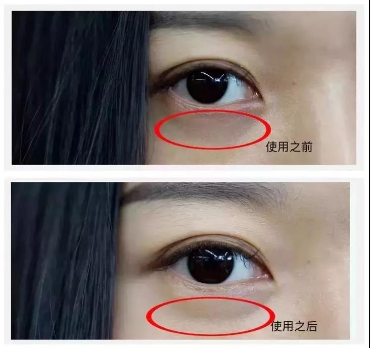 为什么眼睛大会显老？黑眼圈、眼袋、眼纹怎么去除？这两招就够了