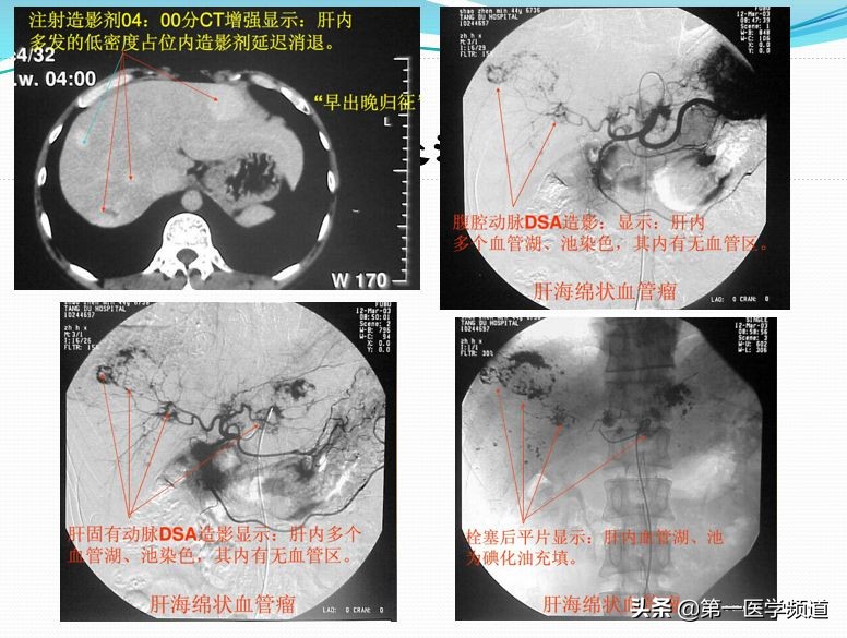 「医影传声」上海交通大学医学院附属瑞金医院卢湾分院放射科主任