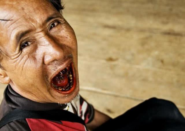 长期嚼槟榔如何自我治愈,每天不停嚼槟榔是什么情况