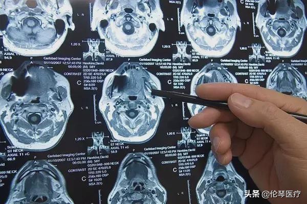 磁共振检查注意事项及禁忌症ppt,磁共振检查注意事项展板