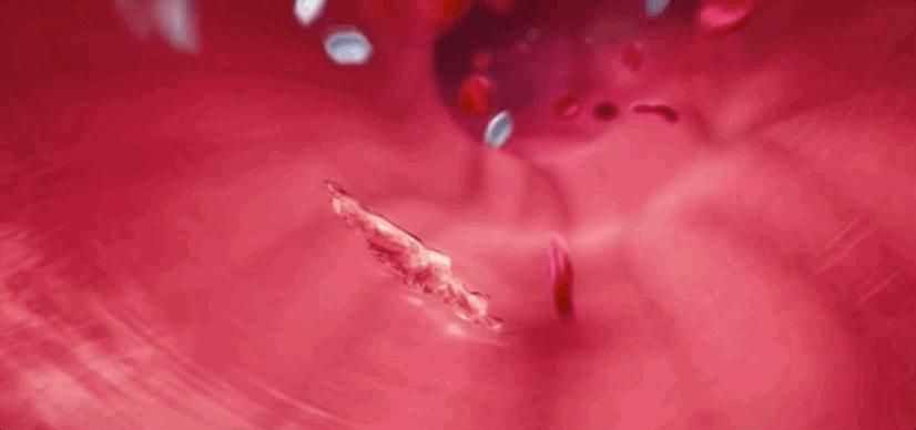 血小板破裂是什么意思,血小板凝固原因