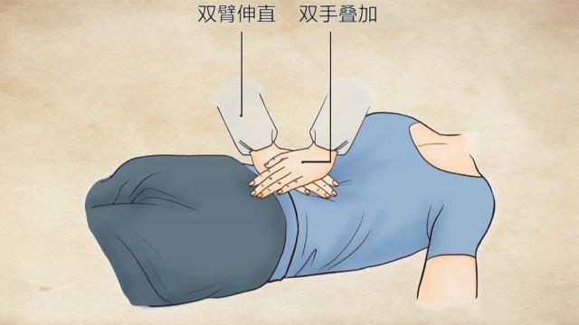 棘上棘间韧带损伤的推拿手法,交叉韧带损伤的推拿治疗