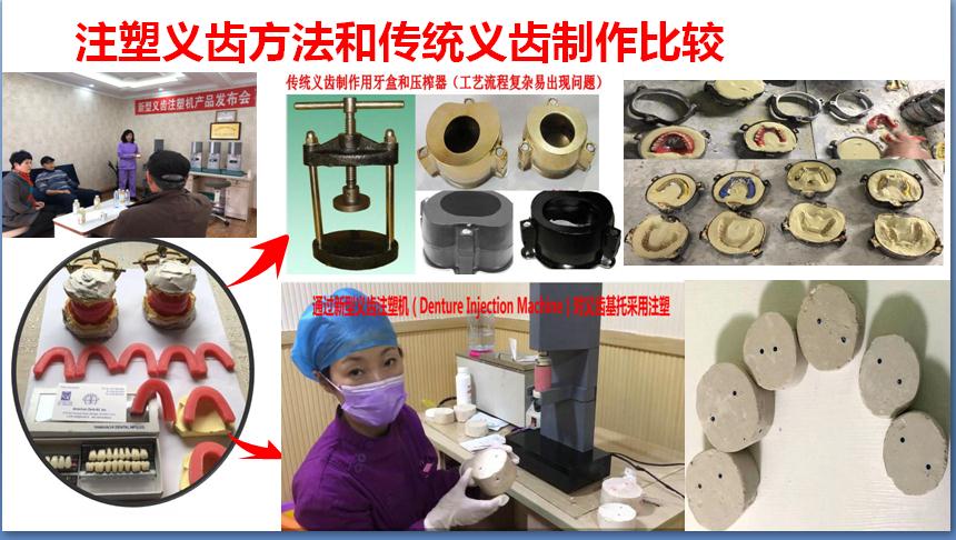 假牙制作纯手工,假牙新材料制作方法